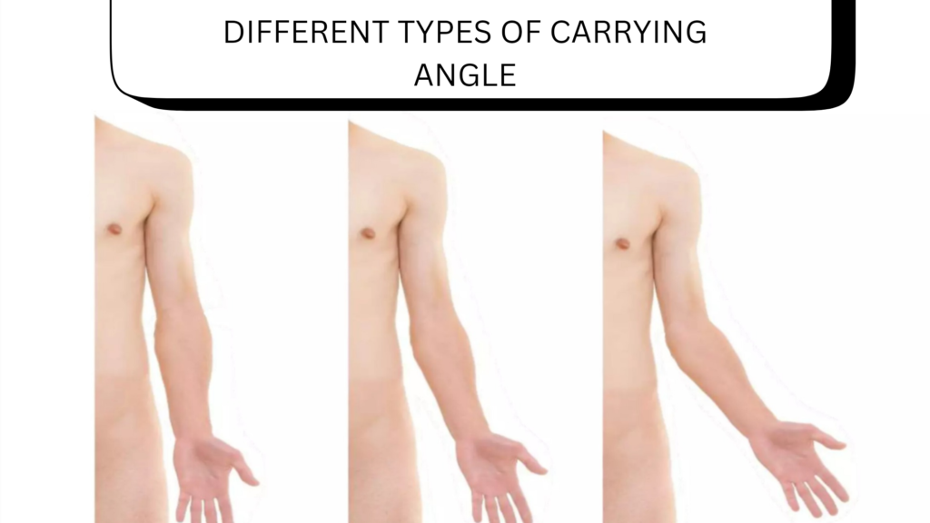 Image of the different carrying angles of a human body