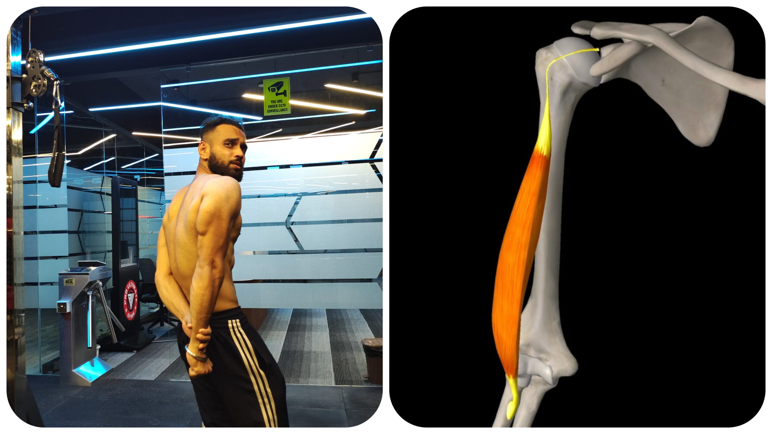 Tricep long head
