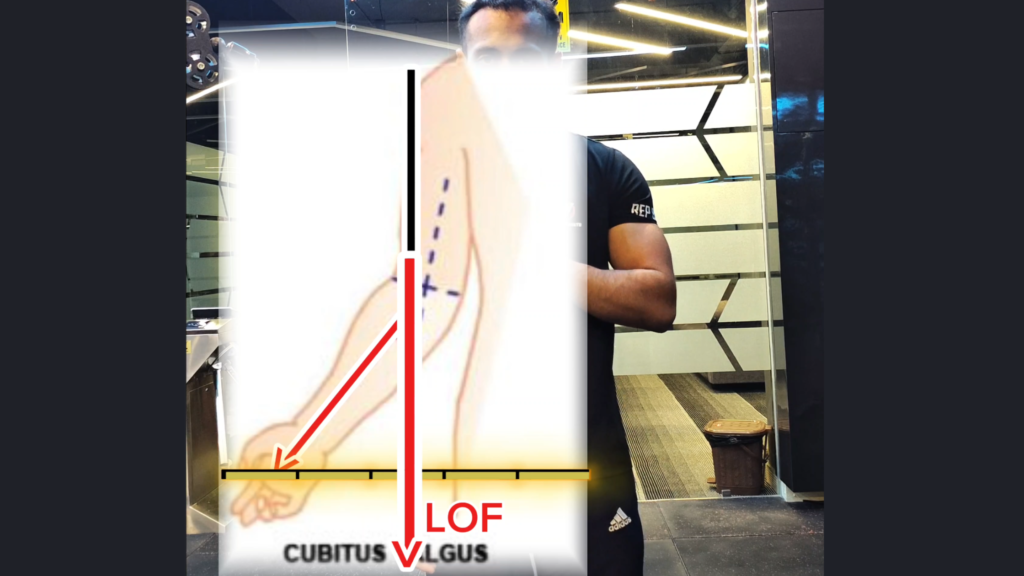 Elbow carrying angle plane